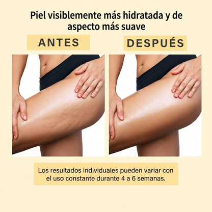 Aceite Anticelulítico Reafirmante